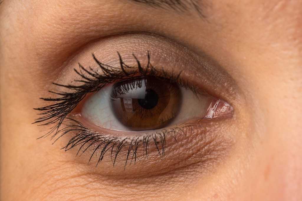 Woman with Eye Bags in Washington D.C.