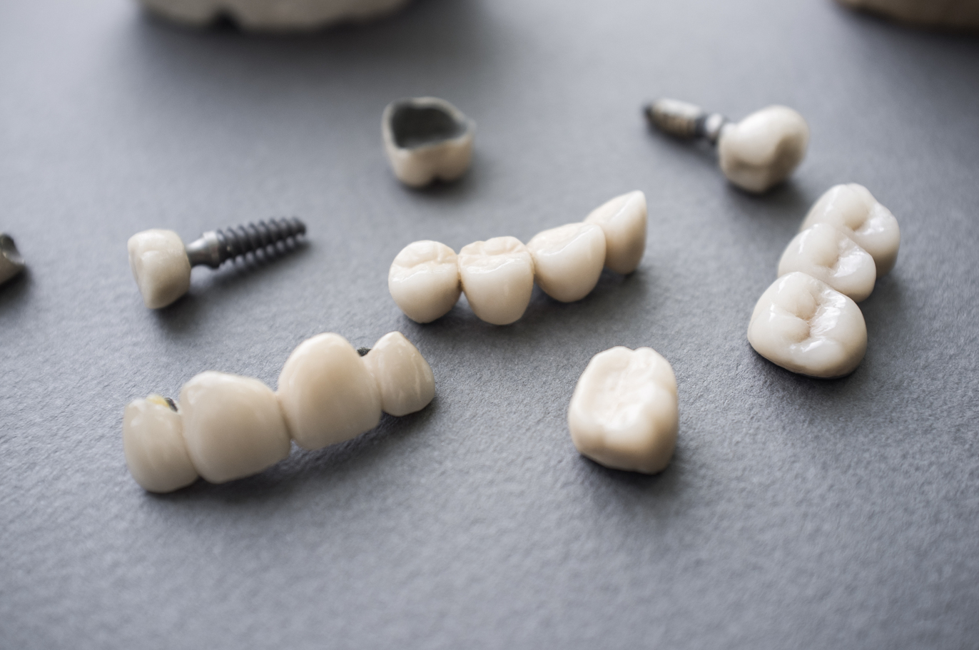 dental implants on a table
