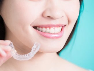 a woman with clear braces