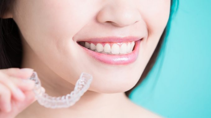 a woman with clear braces