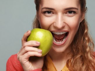 Woman with dental braces bitting anpple