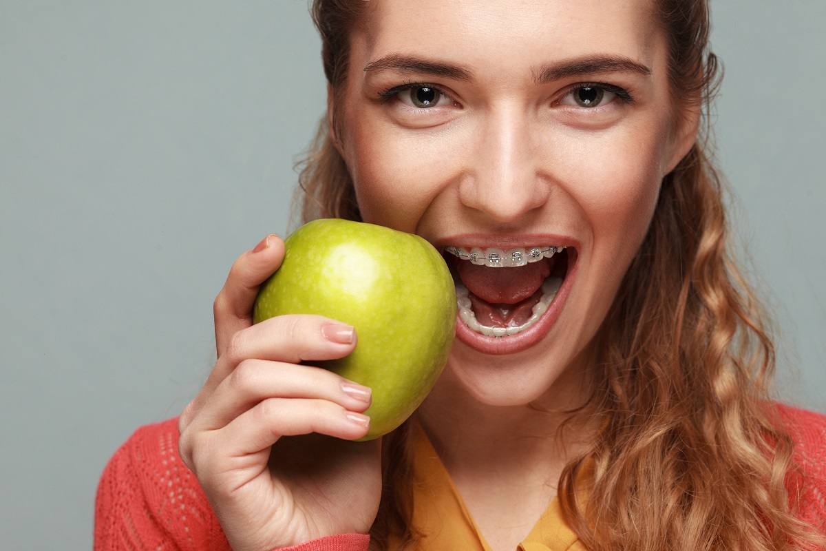 Woman with dental braces bitting anpple